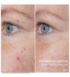 Power Serum Ampoules. Hyaluronic Acid - DOCTOR BABOR 9 Power Serum Ampoules. Hyaluronic Acid - DOCTOR BABOR -Cosmeticos24h Tienda Power Serum Ampoules Hyaluronic Acid DOCTOR BABOR 651