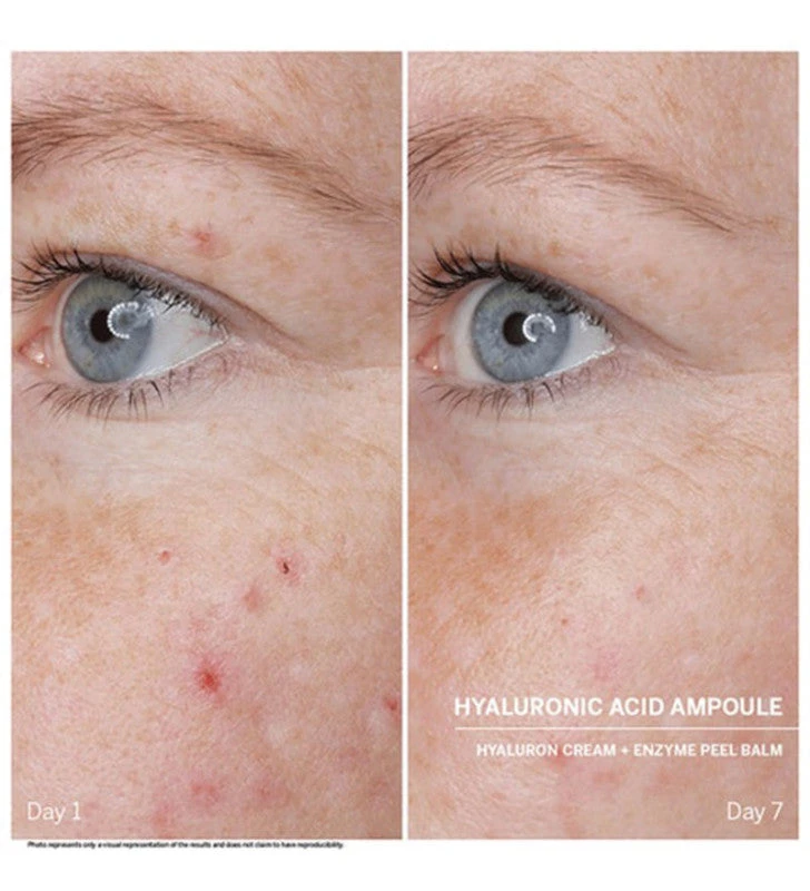 Power Serum Ampoules. Hyaluronic Acid - DOCTOR BABOR 3 Power Serum Ampoules. Hyaluronic Acid - DOCTOR BABOR - Imagen 3