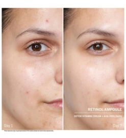 Power Serum Ampoules. Retinol - DOCTOR BABOR -Cosmeticos24h Tienda Power Serum Ampoules Retinol DOCTOR BABOR 659